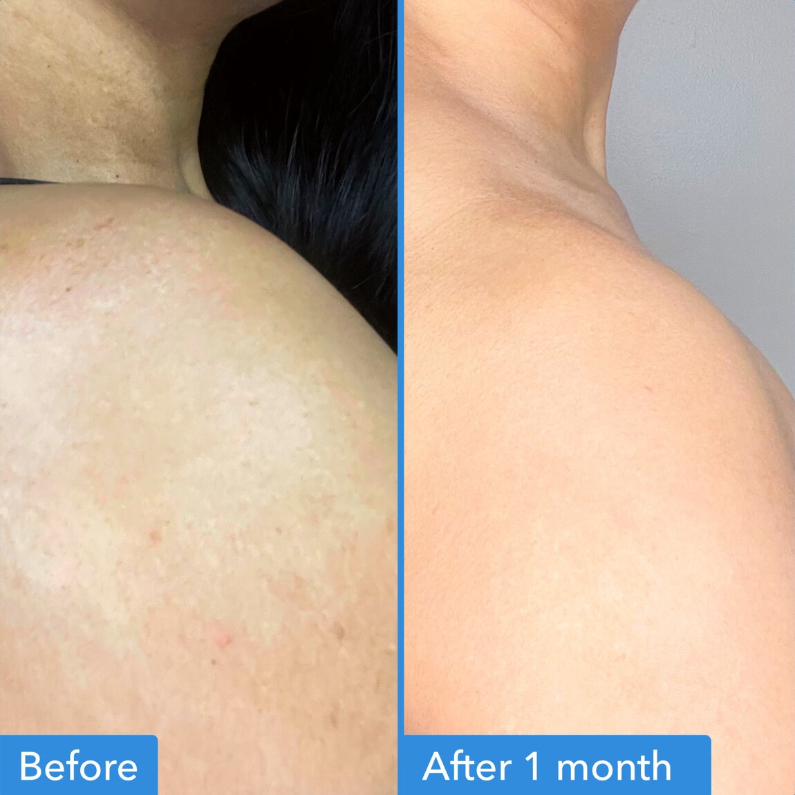 discoloration-correcting-body-treatment-x7 zb_p.jpg