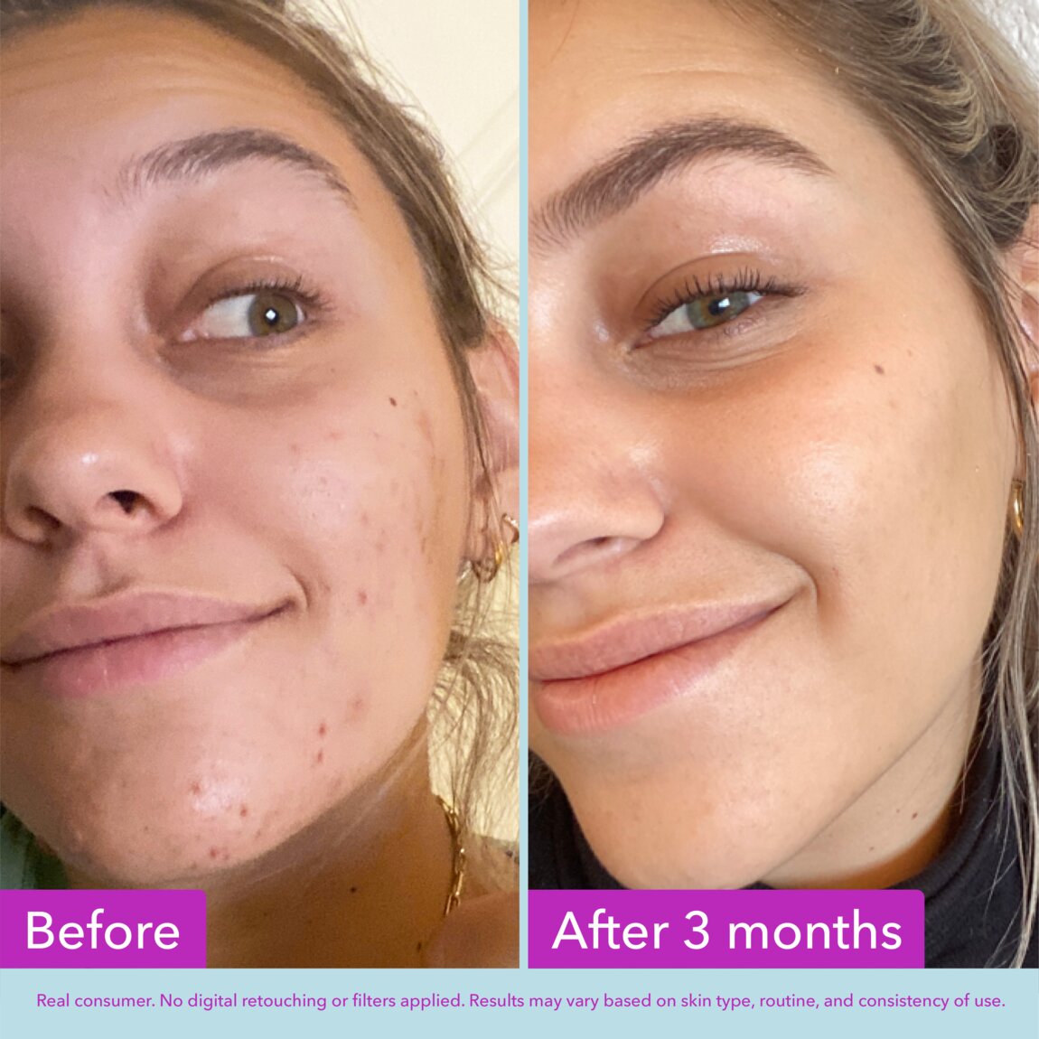 niacinamide-brightening-toner-x1 zb_p.jpg